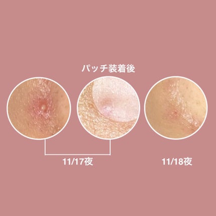 バルンソンリペアキット/SKINSBIBLE/その他スキンケアを使ったクチコミ(3枚目)