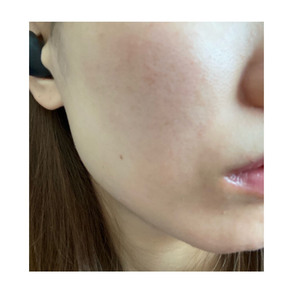 CELL CURE 4Tプラス/BELEGA/美顔器・マッサージを使ったクチコミ（2枚目）