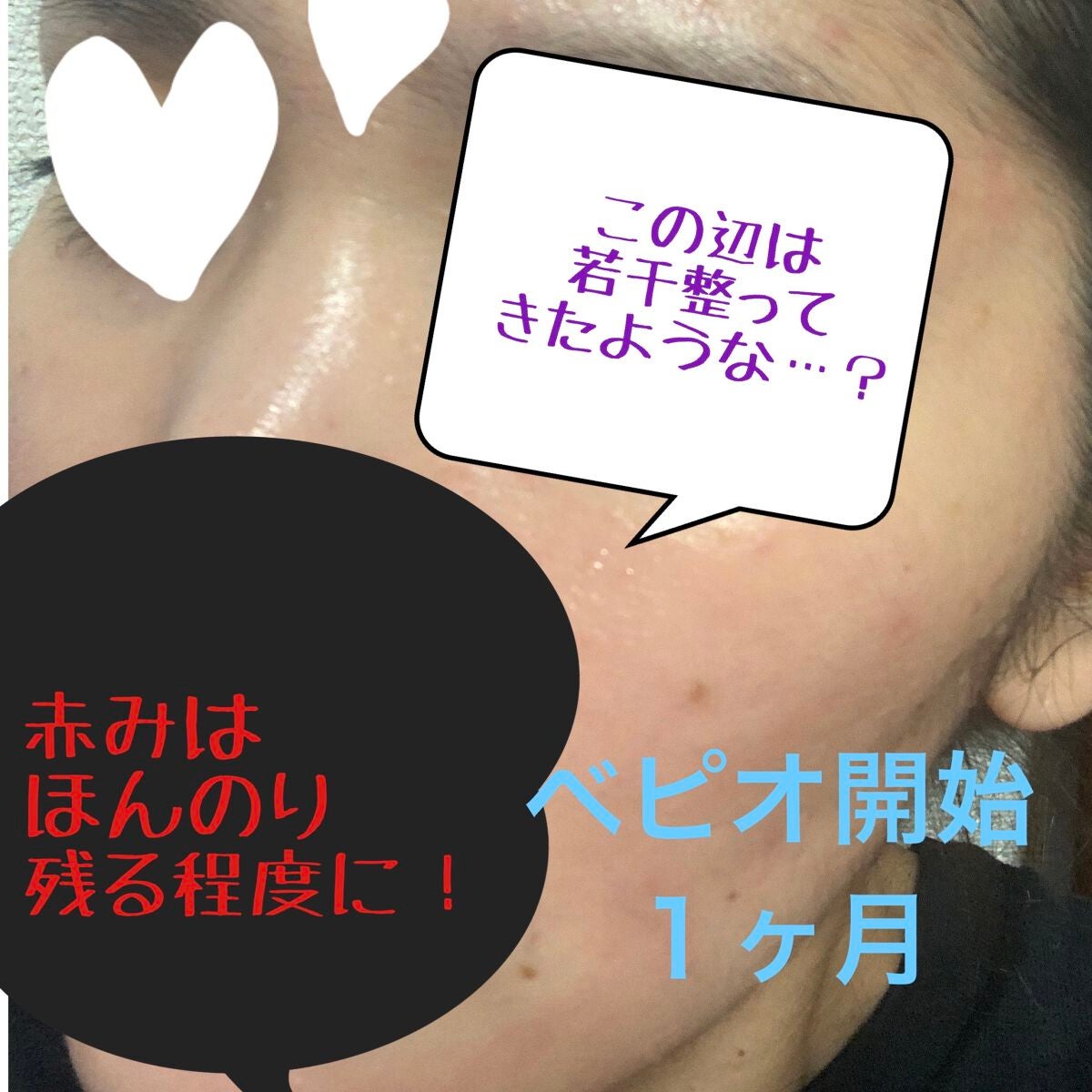 菊正宗 日本酒の化粧水 高保湿/菊正宗/化粧水を使ったクチコミ(7枚目)