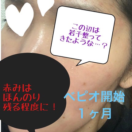 菊正宗 日本酒の化粧水 高保湿/菊正宗/化粧水を使ったクチコミ(7枚目)