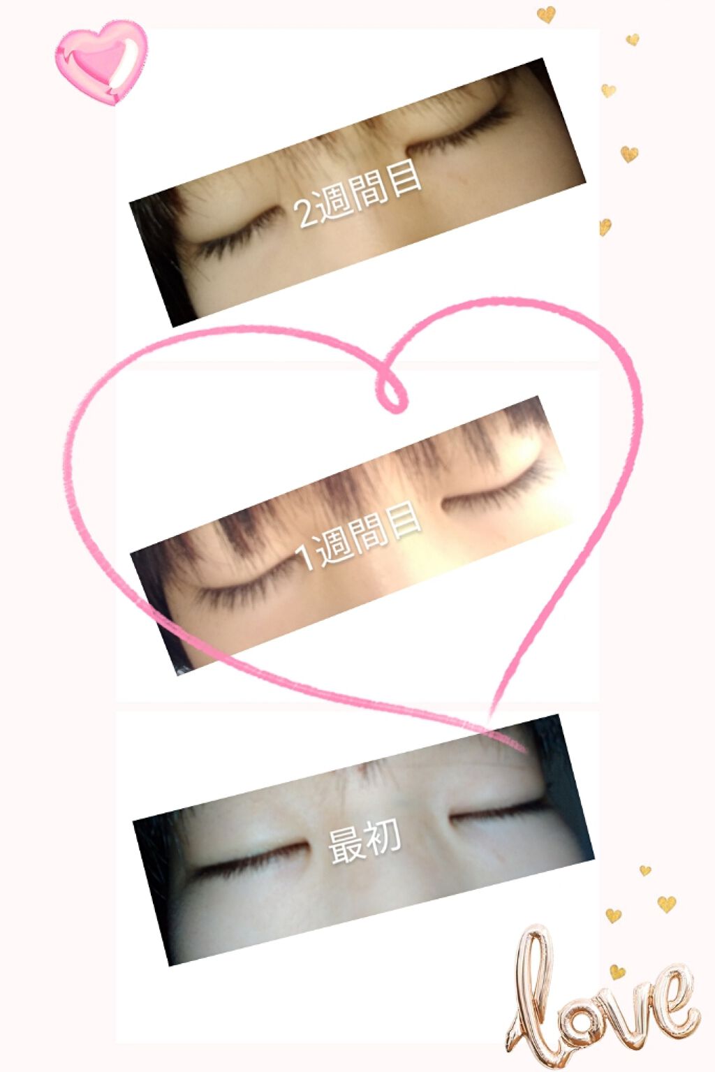 ローヤルゼリー配合 栄養ローション/DAISO/美容液を使ったクチコミ（2枚目）