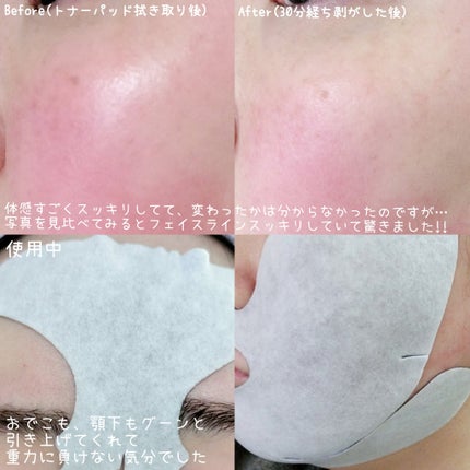 リフティングマスク/DEWYCEL/シートマスク・パックを使ったクチコミ(9枚目)