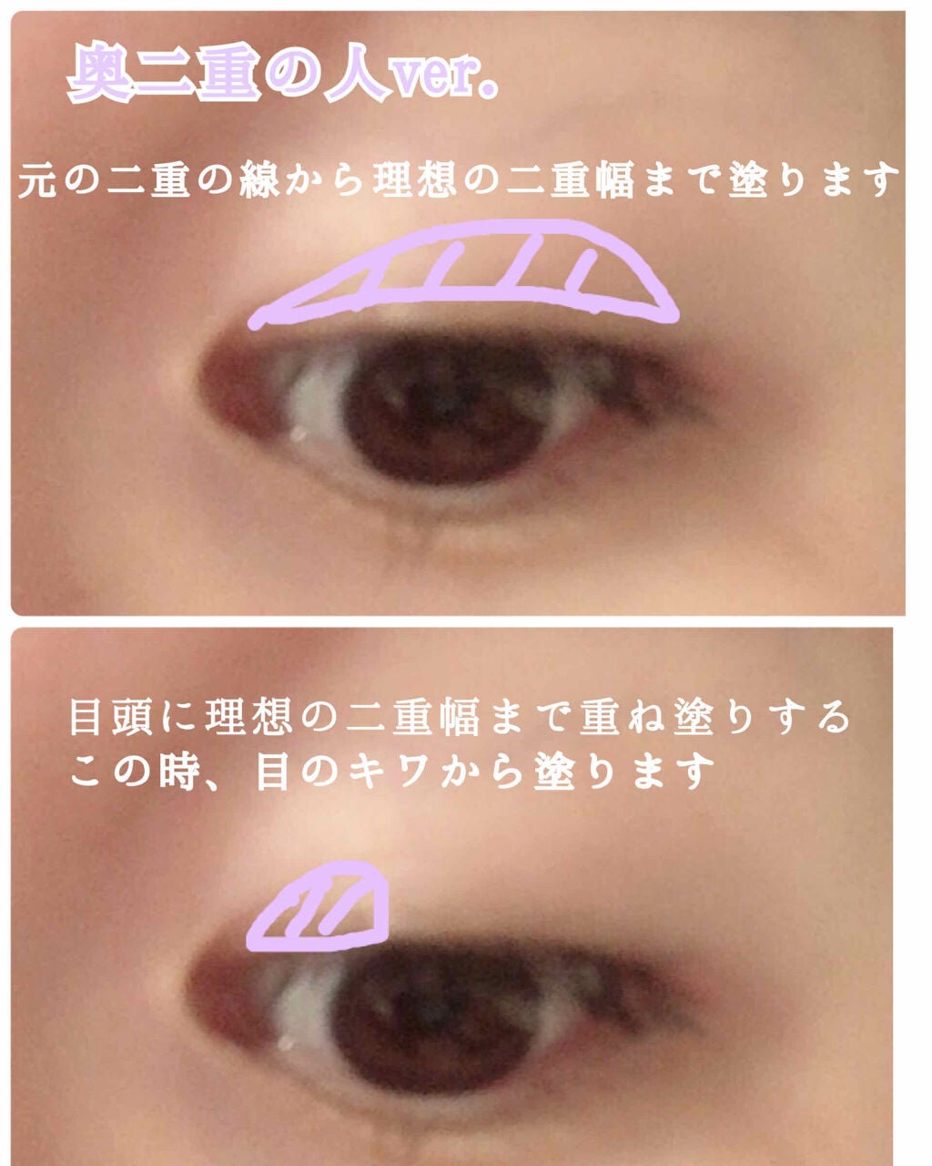 リキッドフィルム ラクオリの使い方を徹底解説 自力で二重にしたい方集まれ By ゆの 敏感肌 代後半 Lips リキッドフィルム ラクオリの使い方を徹底解説 自力で二重にしたい方集まれ By ゆの 敏感肌 代後半 Lips