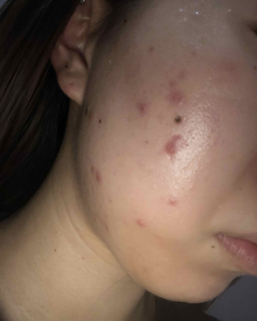 敏感肌用薬用美白美容液/無印良品/美容液を使ったクチコミ（2枚目）