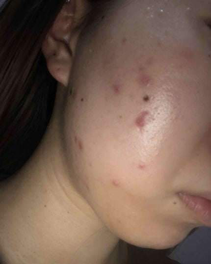 敏感肌用薬用美白美容液/無印良品/美容液を使ったクチコミ(2枚目)