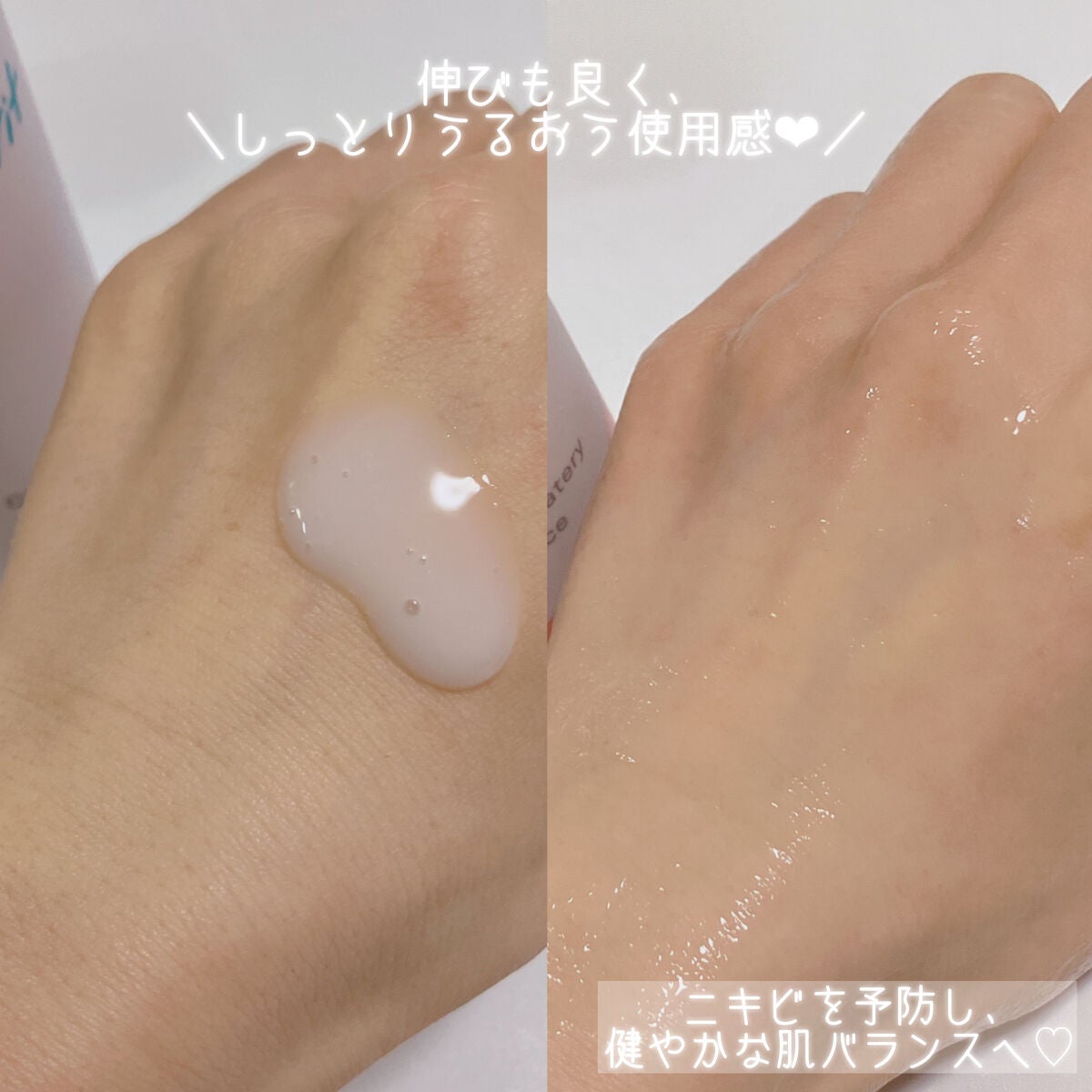 スキンピールバー ティートゥリー/サンソリット/洗顔石鹸を使ったクチコミ(6枚目)