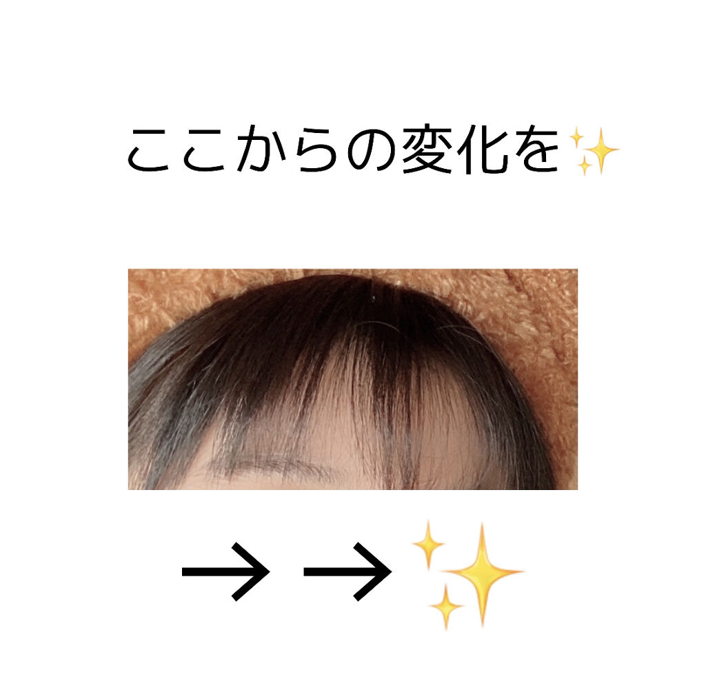 まとめ髪スティック スーパーホールド/マトメージュ/ヘアワックス・クリームを使ったクチコミ（2枚目）