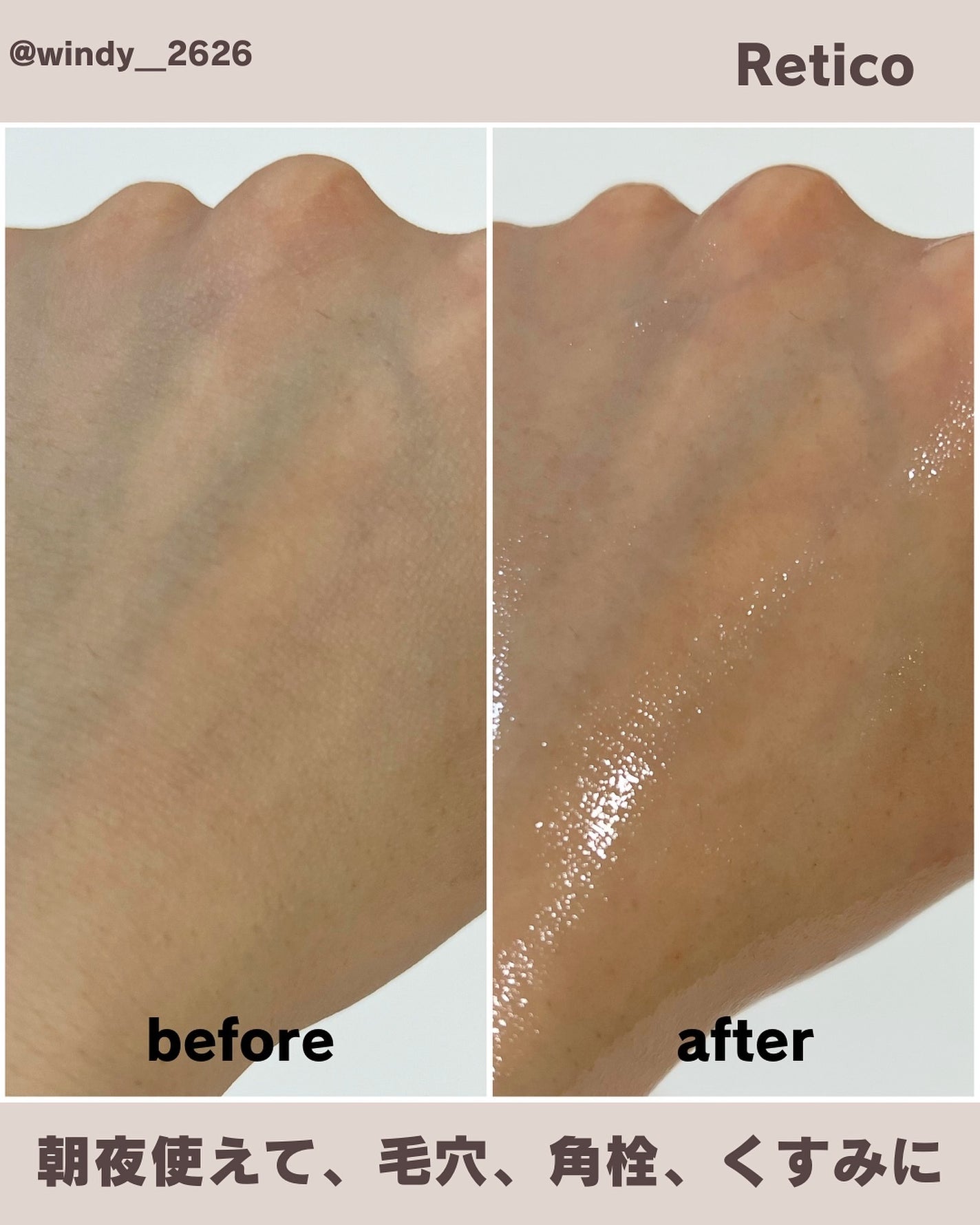 RETICO./RETICO./美容液を使ったクチコミ(4枚目)