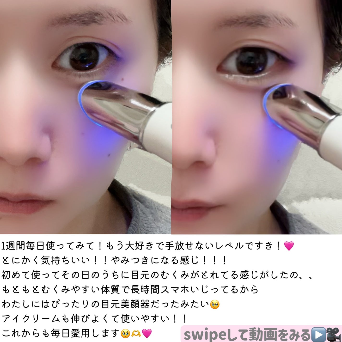 エンリッチドアイクリーム/ANLAN/フェイスクリームを使ったクチコミ(4枚目)