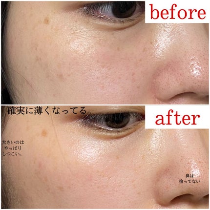 EUKROMA ハイドロキノンクリーム4% 20g/EUKROMA/その他スキンケアを使ったクチコミ(2枚目)
