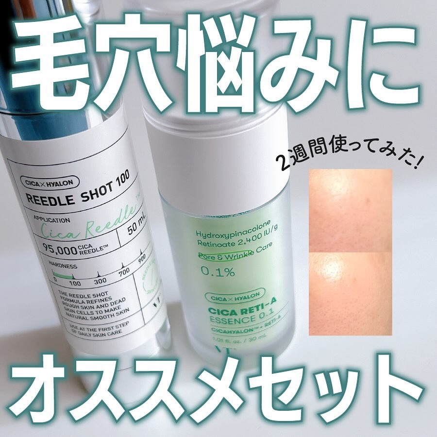 シカレチA エッセンス0.1/VT/美容液を使ったクチコミ（1枚目）