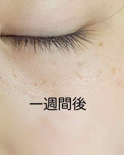 ローヤルゼリー配合 栄養ローション/DAISO/美容液を使ったクチコミ(3枚目)