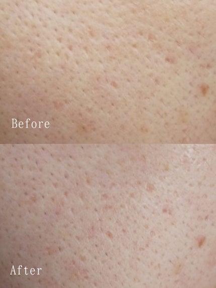 V エッセンス/unlabel/美容液を使ったクチコミ(3枚目)