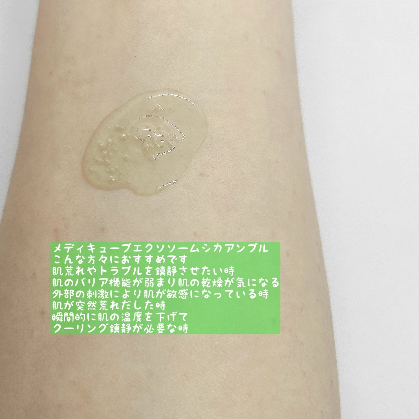 エクソソームシカ アンプル/MEDICUBE/美容液を使ったクチコミ(3枚目)