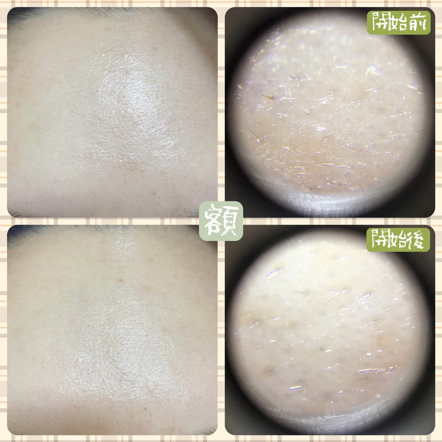 リードルショット100/VT/美容液を使ったクチコミ(3枚目)