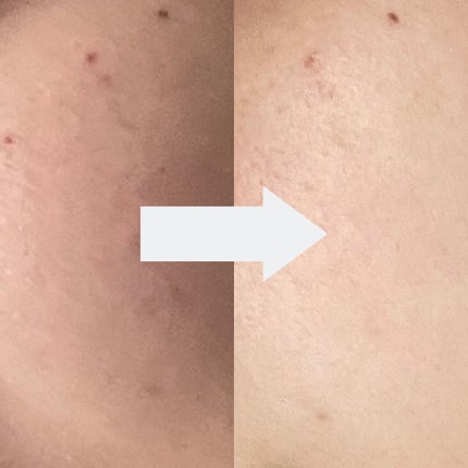 バイオ コンディショニング エッセンス/IOPE/ブースター・導入液を使ったクチコミ(2枚目)