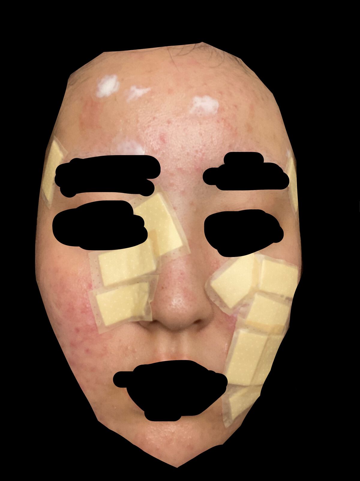 オードムーゲ 薬用ローション(ふきとり化粧水)/オードムーゲ/拭き取り化粧水を使ったクチコミ(4枚目)