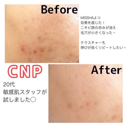 プロポリス エネルギーアンプル/CNP Laboratory/美容液を使ったクチコミ(5枚目)