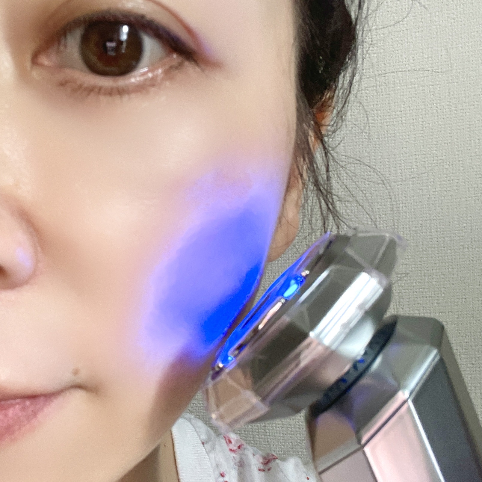 RF温冷美顔器/ANLAN/美顔器・マッサージを使ったクチコミ（3枚目）