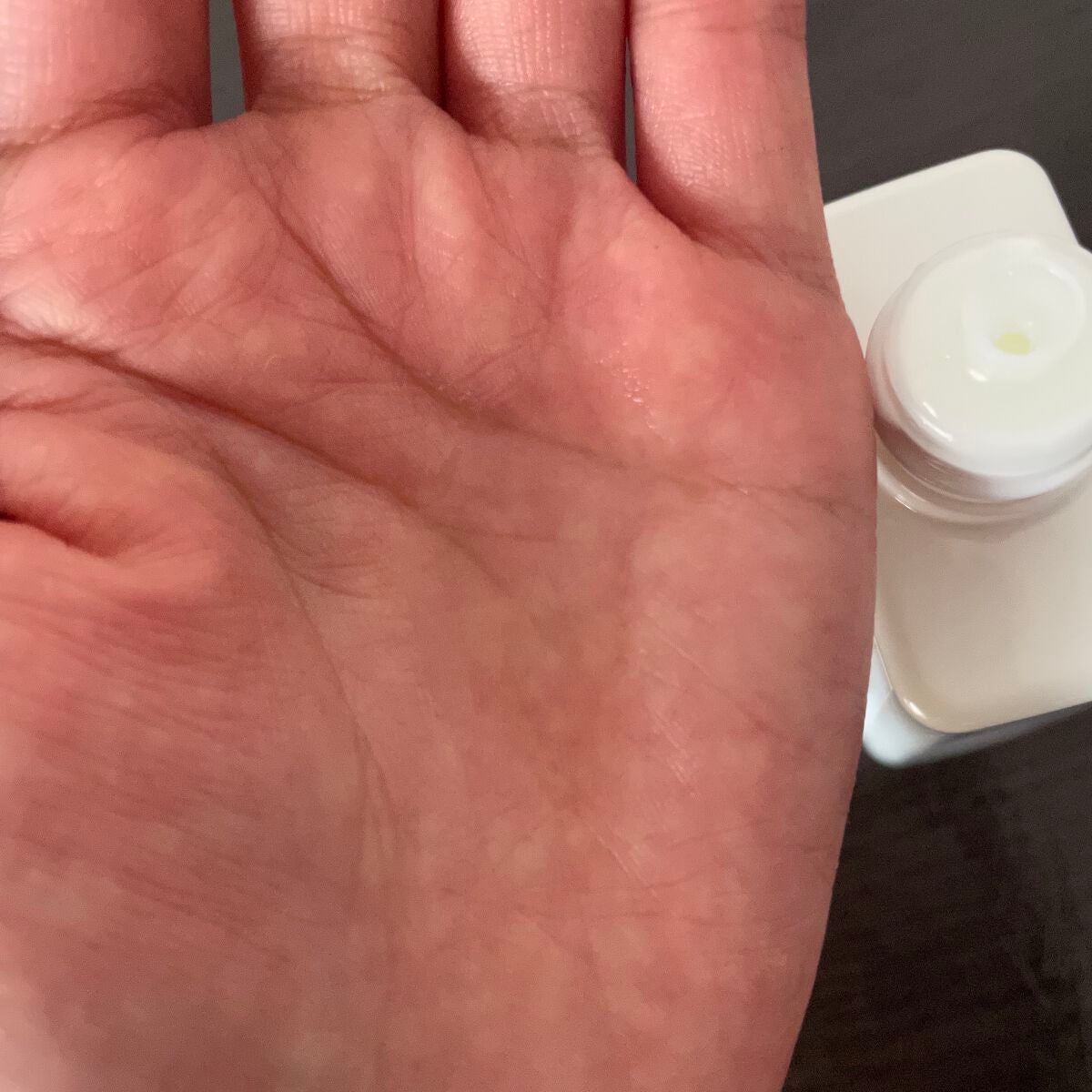 バランシングGAローション/TOUT VERT/化粧水を使ったクチコミ(4枚目)