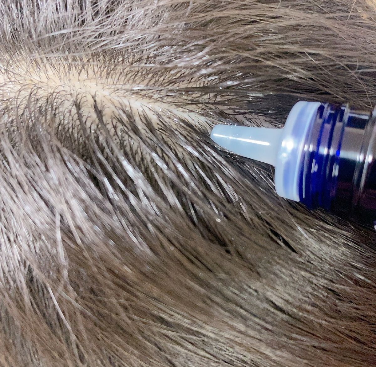 Wアプローチヘアプログラム/MUNOAGE(ミューノアージュ)/頭皮ローションを使ったクチコミ(9枚目)