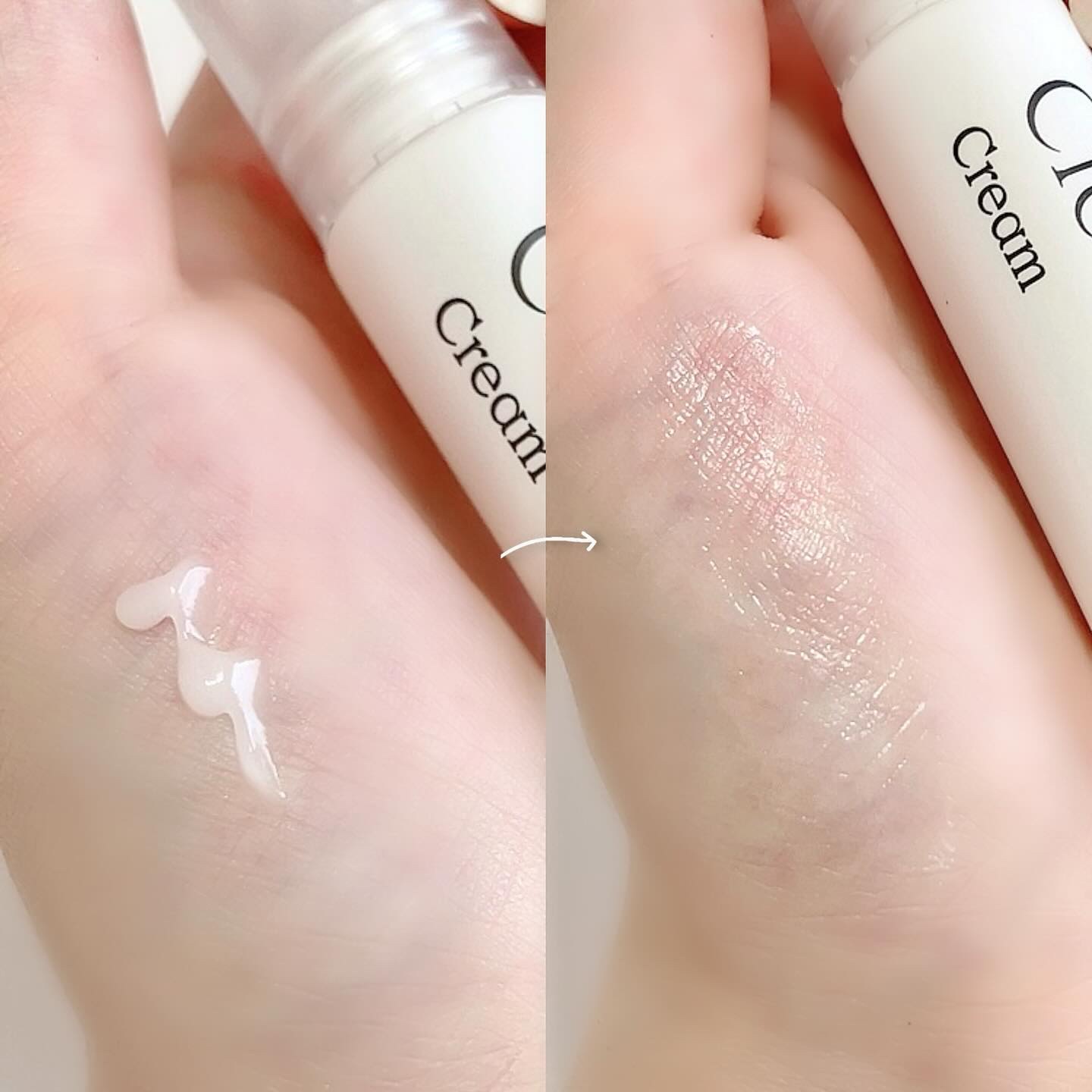 シカスポットクリーム/NATURAL DERMA PROJECT/フェイスクリームを使ったクチコミ（2枚目）