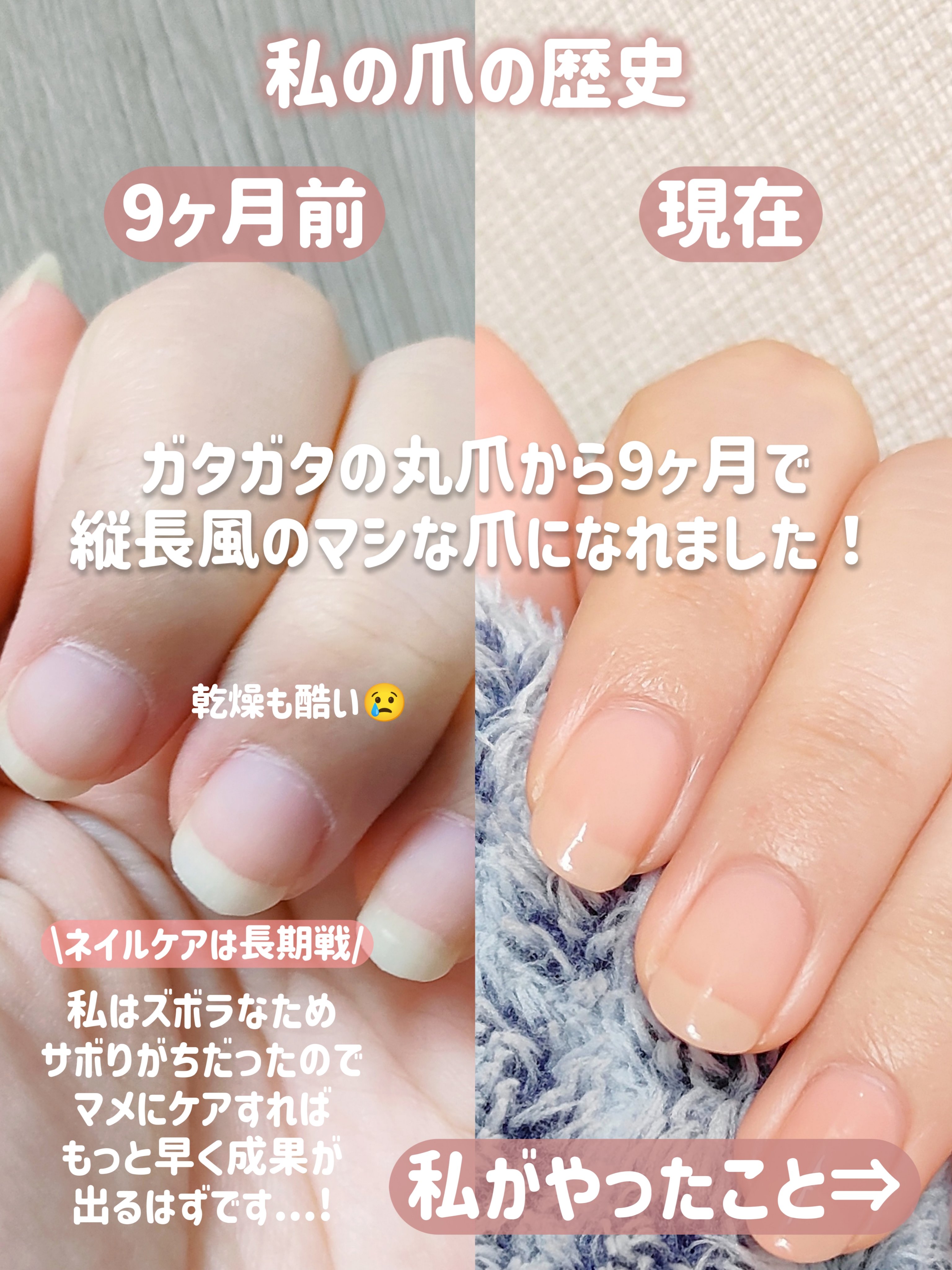 ネイルベッドオイル/アンドネイル/ネイルオイル・トリートメントを使ったクチコミ（2枚目）