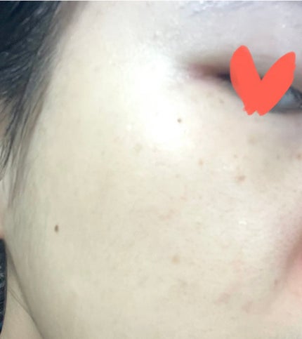 復活草ビフィダセラムファーミングドロップ/Abib /美容液を使ったクチコミ(7枚目)