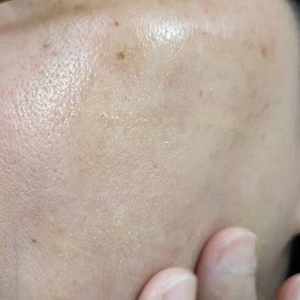 8デイズピュアビタミンCアンプル/VARI:HOPE/美容液を使ったクチコミ(4枚目)