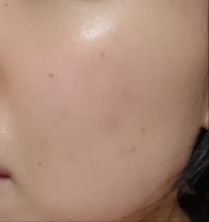 インビジブルピーリングブースターエッセンス/CNP Laboratory/ブースター・導入液を使ったクチコミ(2枚目)