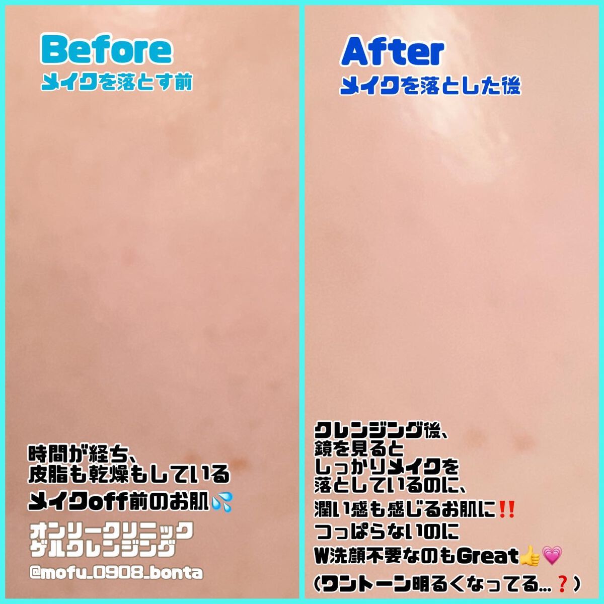 ゲルクレンジング/オンリークリニック/クレンジングジェルを使ったクチコミ(3枚目)