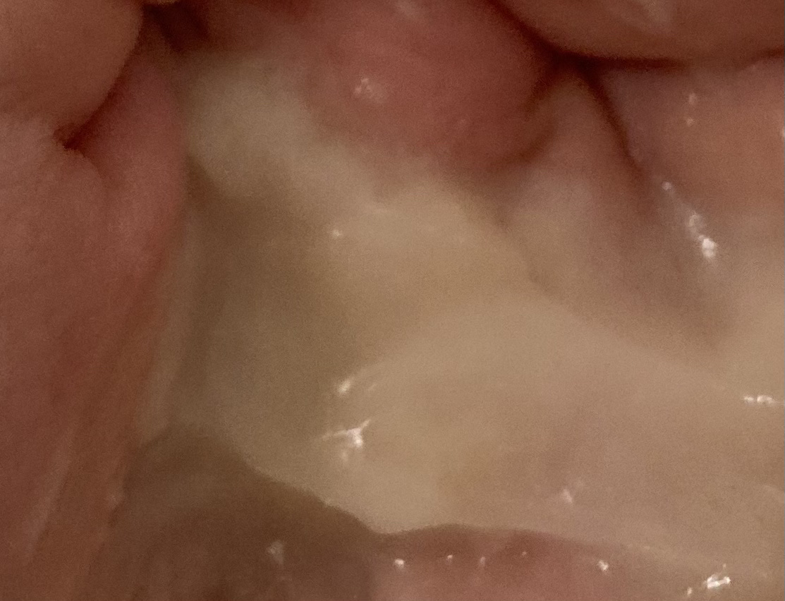 THE PREMIUM エクストラダメージケアシャンプー／トリートメント（シャイニーモイスト）/いち髪/市販シャンプーを使ったクチコミ（3枚目）