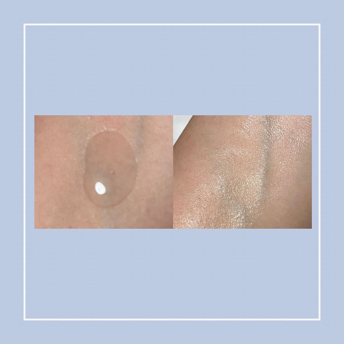 薬用マイクロバブルローション/Macchia Label/化粧水を使ったクチコミ(6枚目)