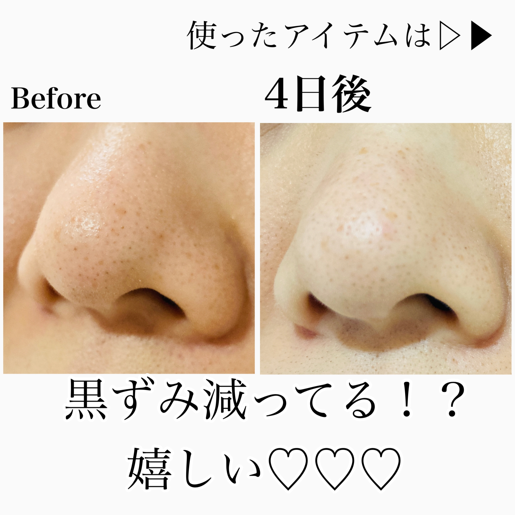 アンジエンド マイクロクレンジングバーム/シーヴァ/クレンジングバームを使ったクチコミ（1枚目）