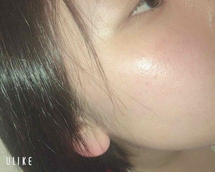 ハトムギ化粧水(ナチュリエ スキンコンディショナー R )/ナチュリエ/化粧水を使ったクチコミ(5枚目)