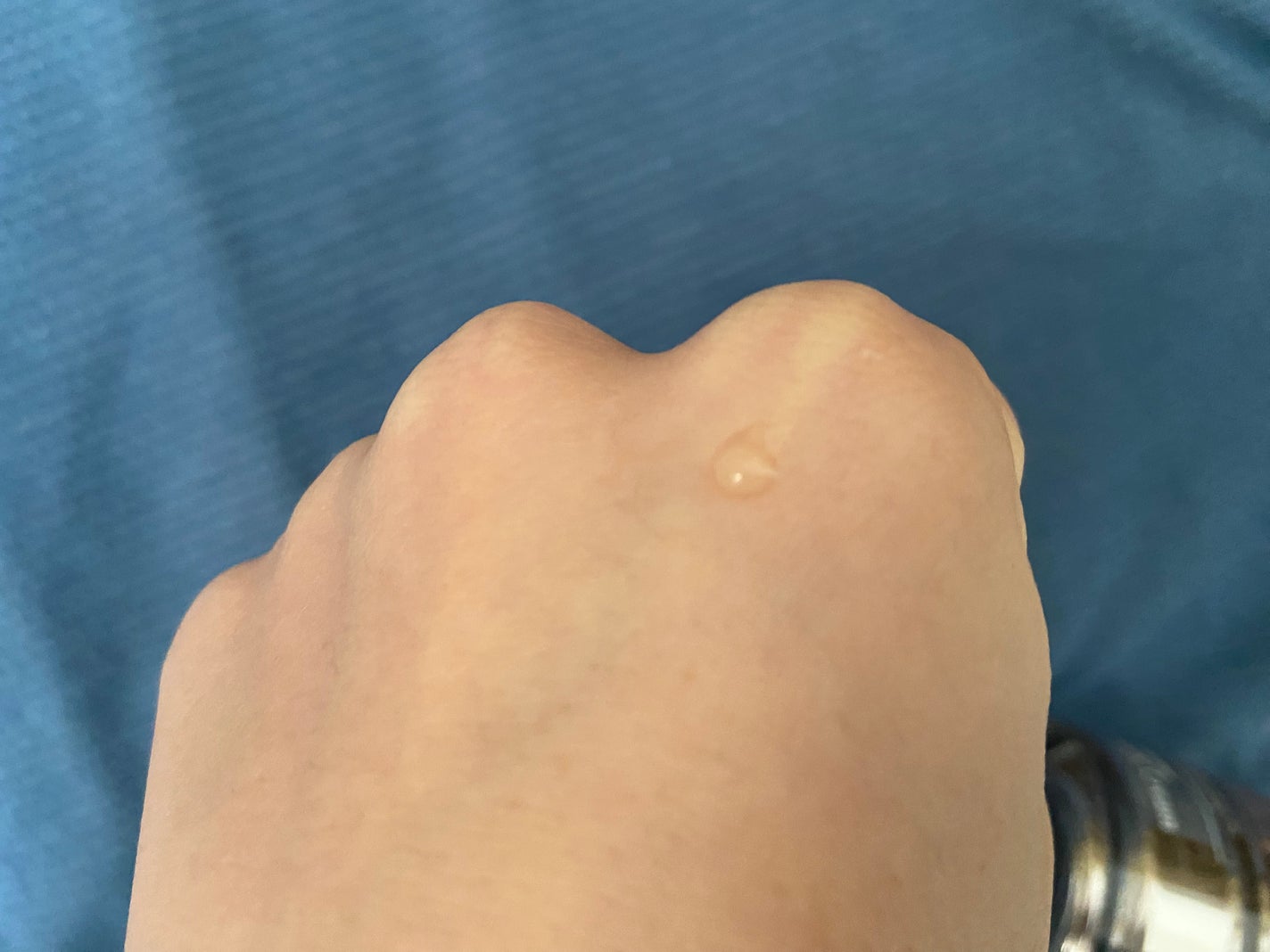 ビフィダバイオーム コンセントレート セラム/manyo/美容液を使ったクチコミ(2枚目)