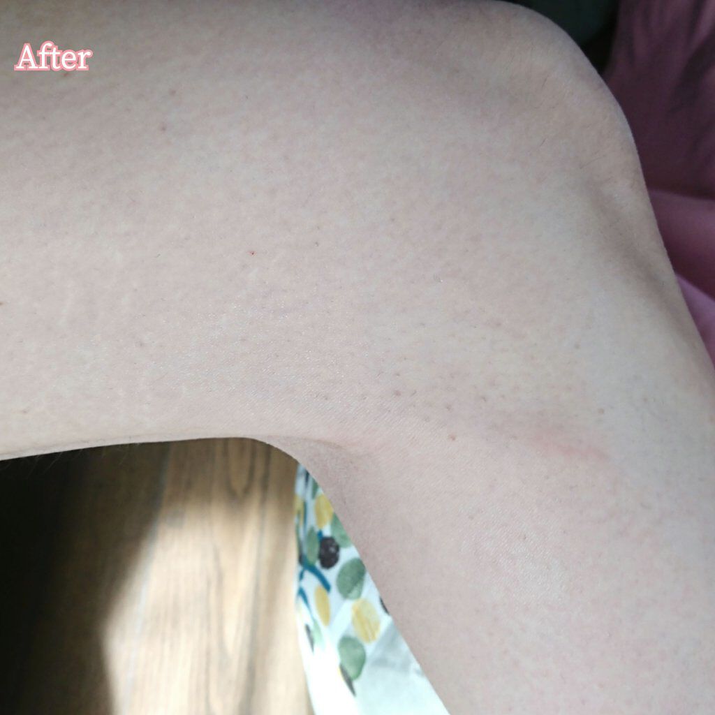 JOOMO/さずかりファミリー/除毛クリームを使ったクチコミ(6枚目)