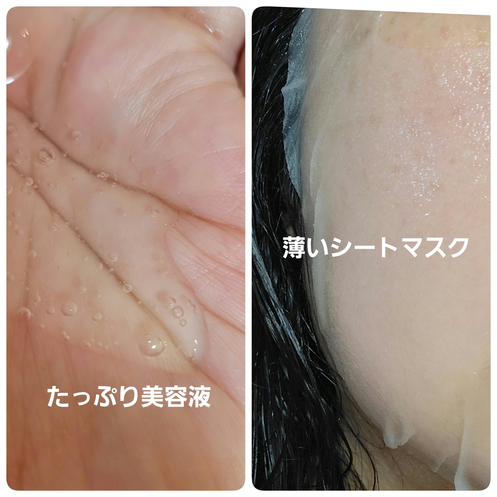 イオナズンアンプルマスク/Freemay/シートマスク・パックを使ったクチコミ（3枚目）