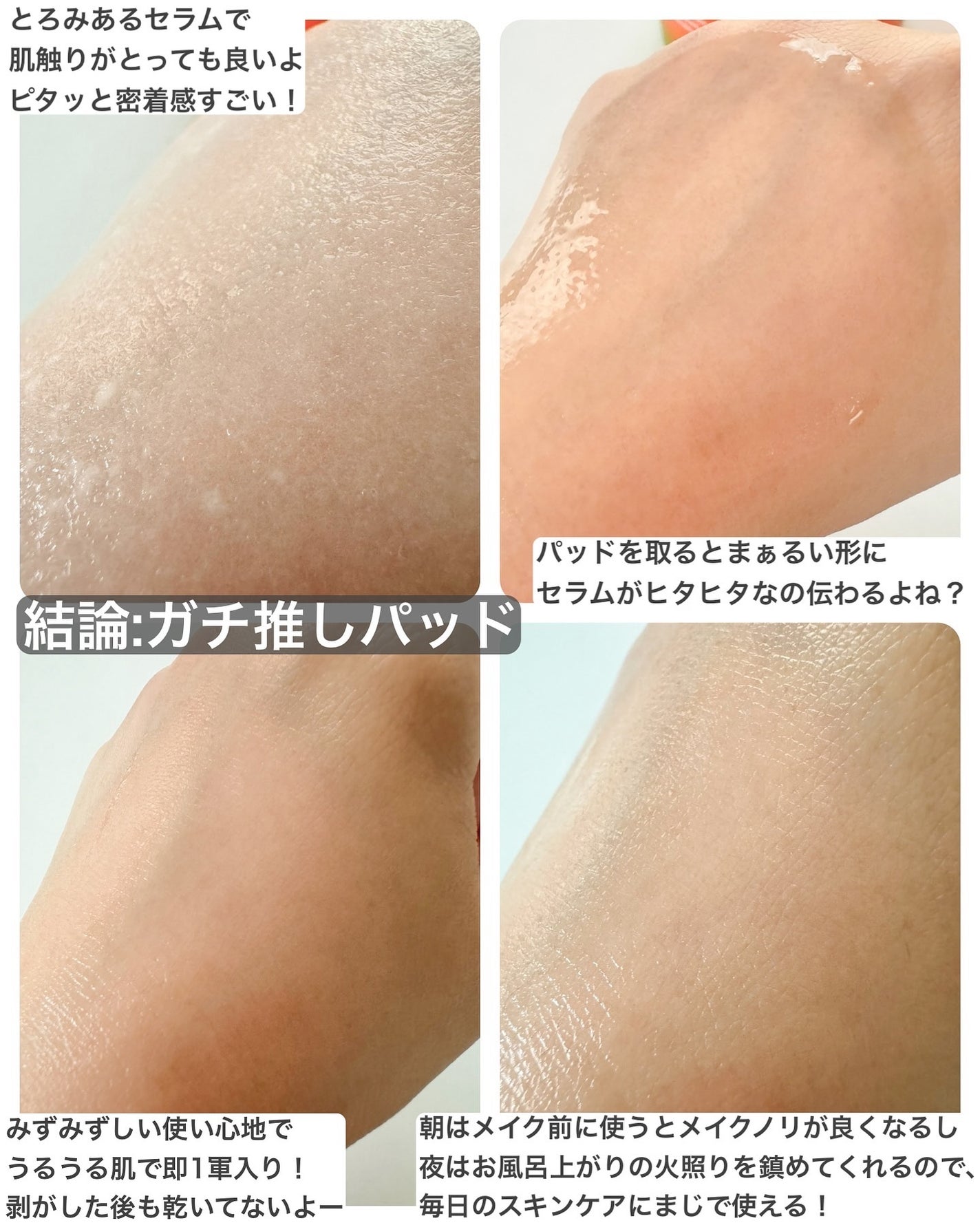 カロテンIPMP(TM) ブレミッシュカーミングセラムパッド/APRILSKIN/トナーパッドを使ったクチコミ(5枚目)