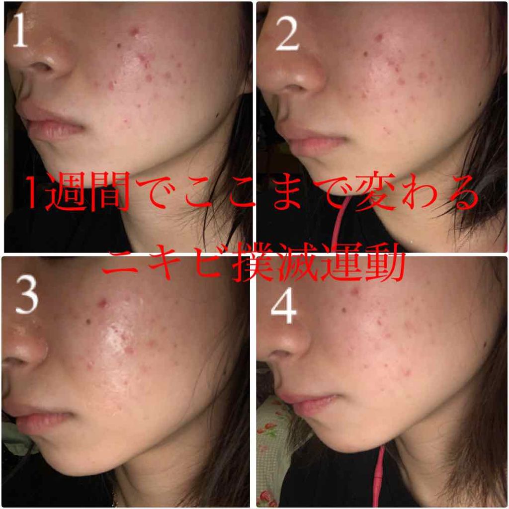 薬用 しみ 集中対策 美容液/メラノCC/美容液を使ったクチコミ(2枚目)