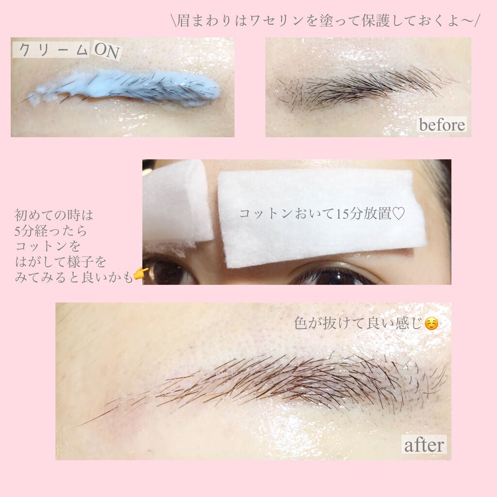 脱色クリーム 敏感肌用/エピラット/ムダ毛ケアを使ったクチコミ(3枚目)