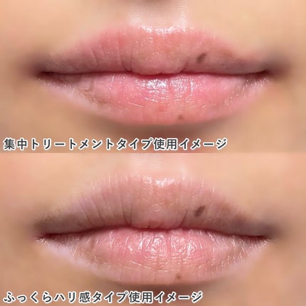 リップパック ふっくらハリ感タイプ<ハーバルハニーの香り>/CHOOSY/リップマスクを使ったクチコミ(6枚目)