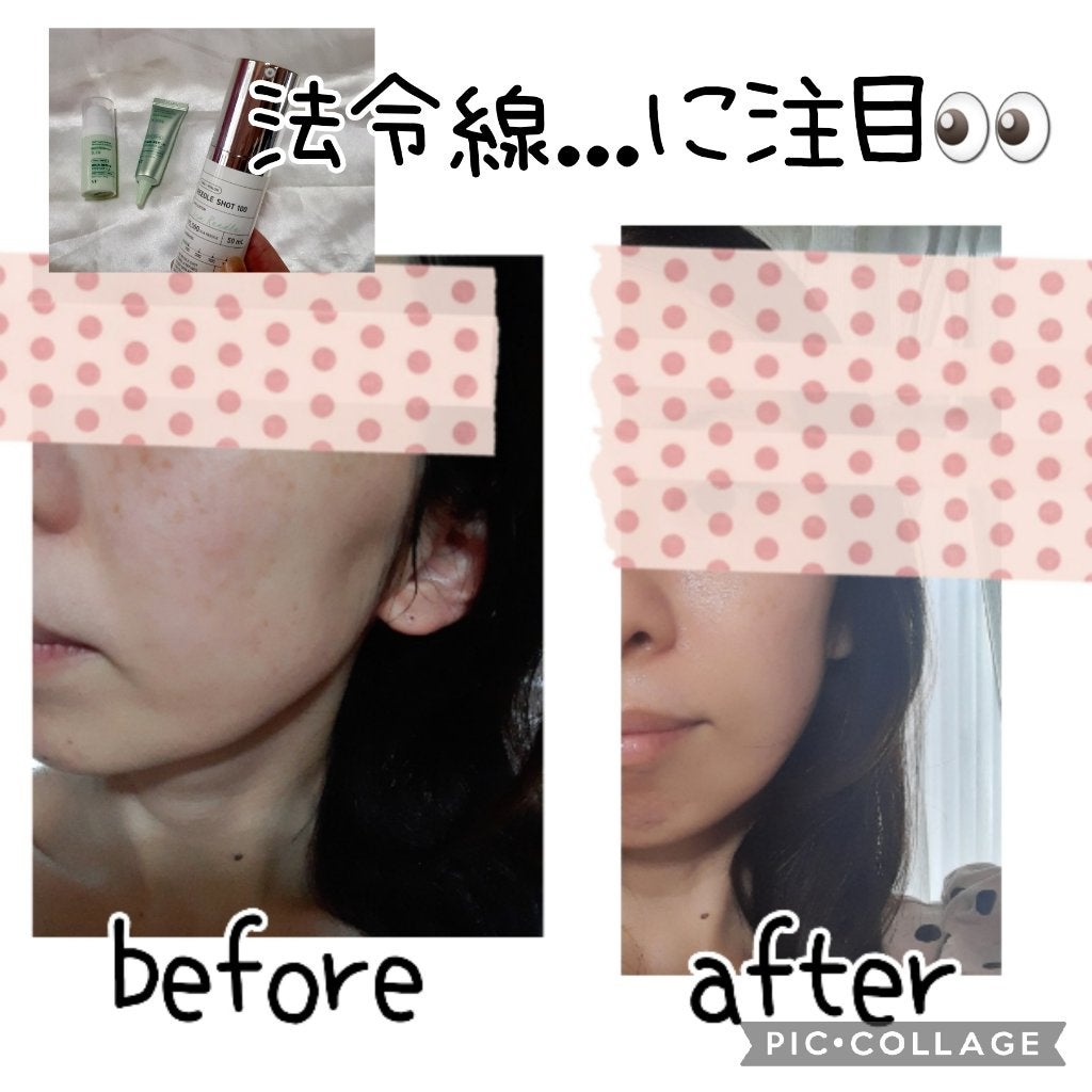 シカレチA エッセンス0.1/VT/美容液を使ったクチコミ(3枚目)