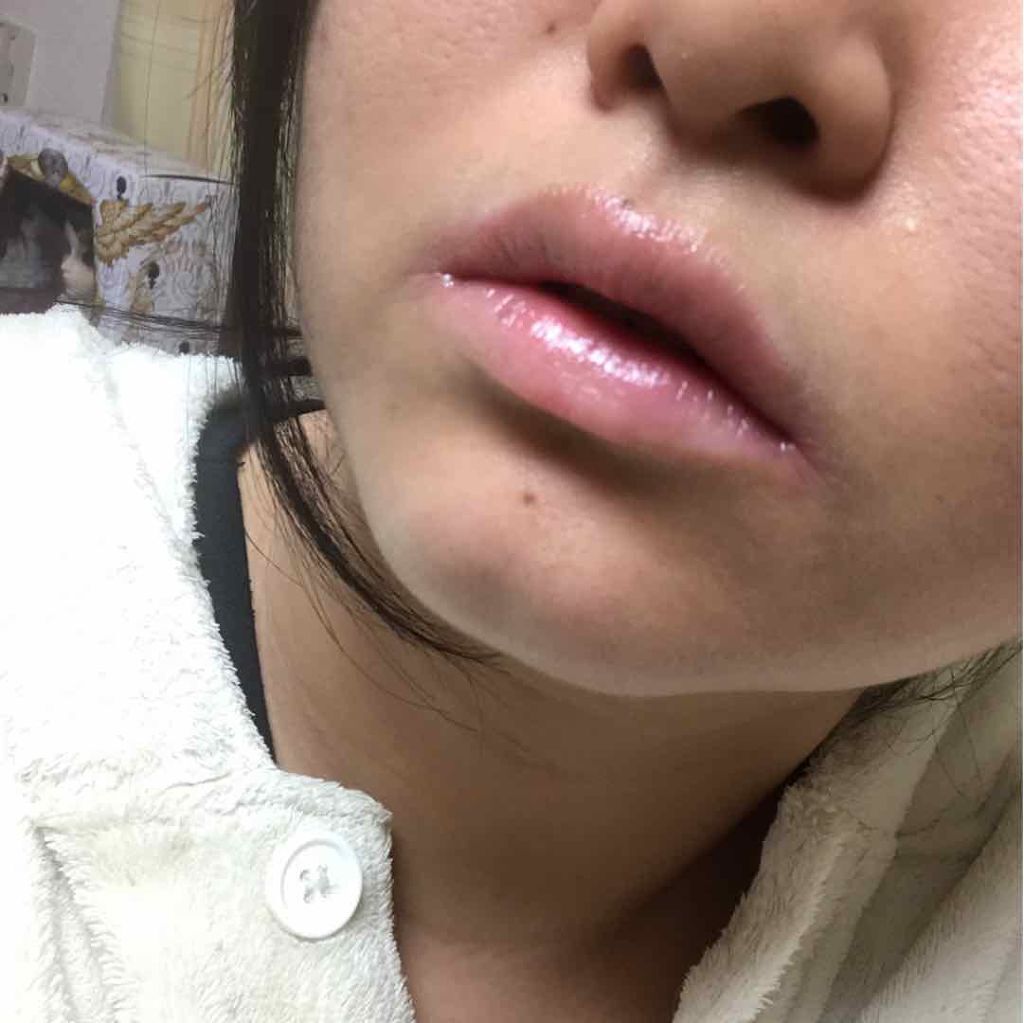 メルティクリームリップ/メンソレータム/リップクリームを使ったクチコミ(2枚目)