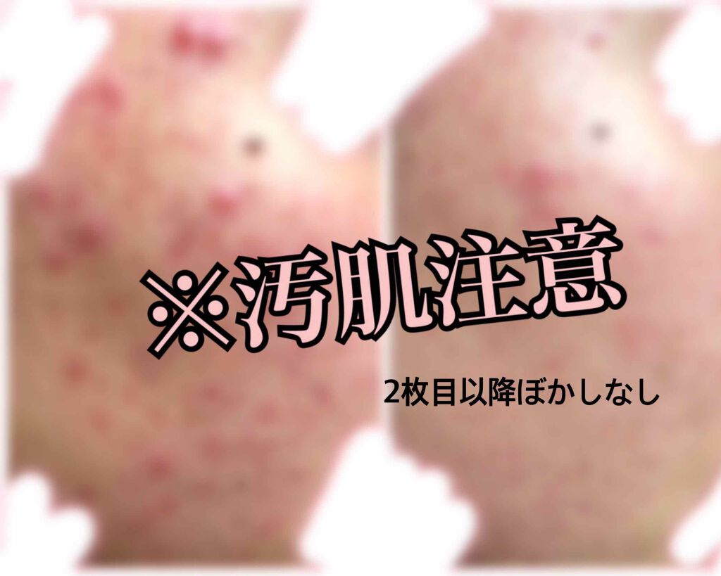 DHC マルチビタミン/DHC/美容サプリメントを使ったクチコミ（1枚目）