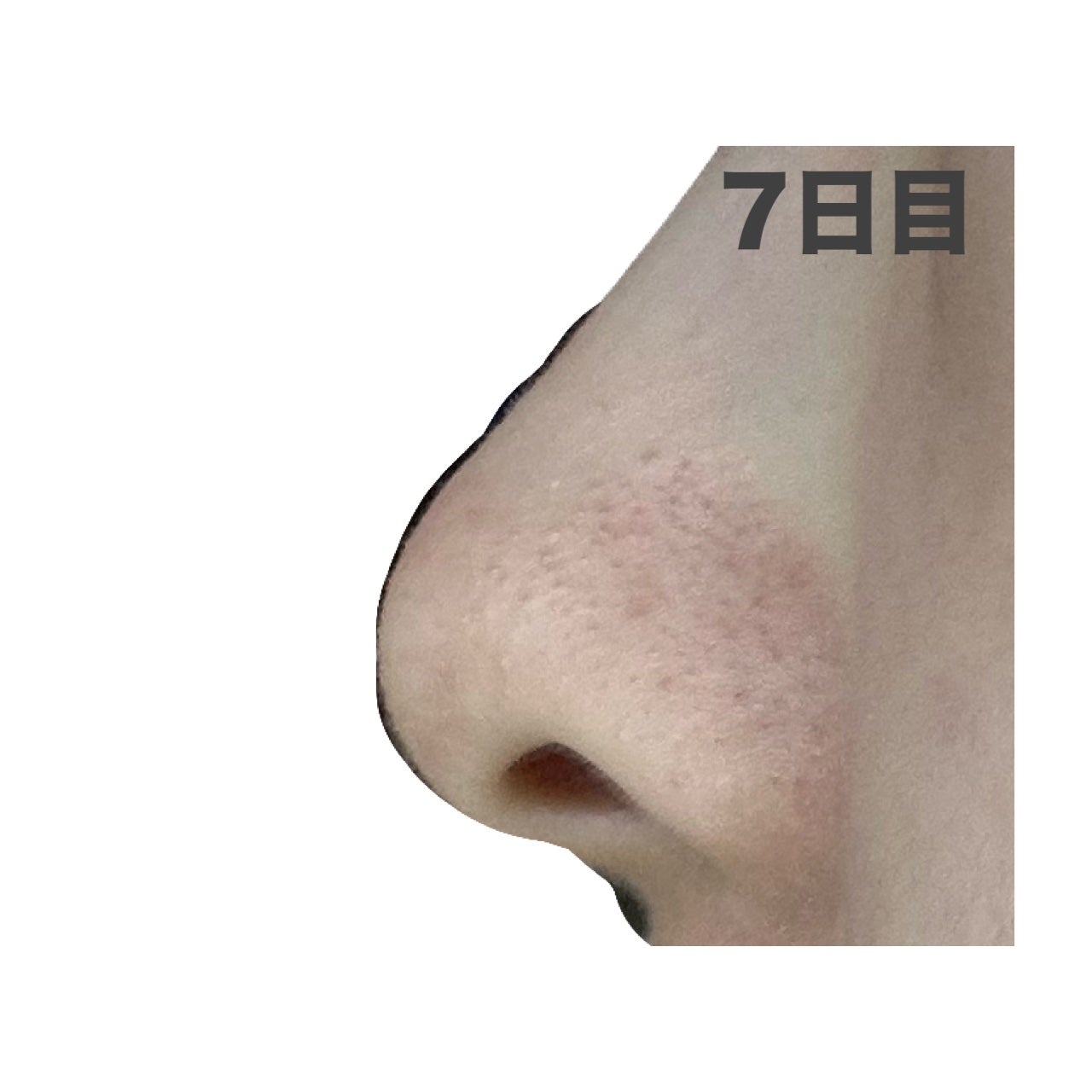 パーフェクトワンフォーカス スムースクレンジングバーム ディープブラック/PERFECT ONE FOCUS/クレンジングバームを使ったクチコミ(5枚目)