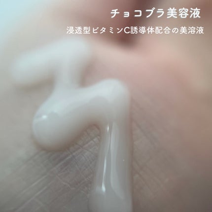 チョコブラ スペシャル毛穴ケアセット/Chocobra/スキンケアキットを使ったクチコミ(7枚目)