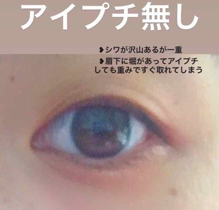 アイビューティー フィクサー WP/アストレア ヴィルゴ/二重まぶた用アイテムを使ったクチコミ(2枚目)