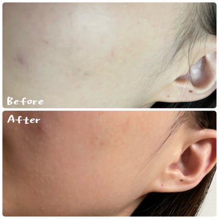 フェイシャルブースティングスパ/Makeon/美顔器・マッサージを使ったクチコミ(3枚目)