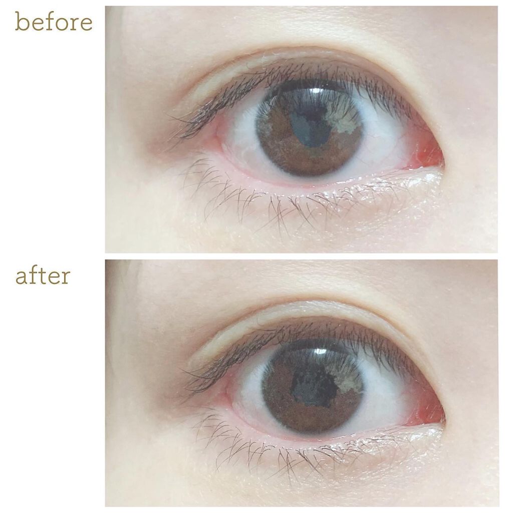 ETERNITY LINE α+/Girl's Maker/二重まぶた用アイテムを使ったクチコミ（2枚目）